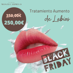 Tratamiento Aumento de Labios